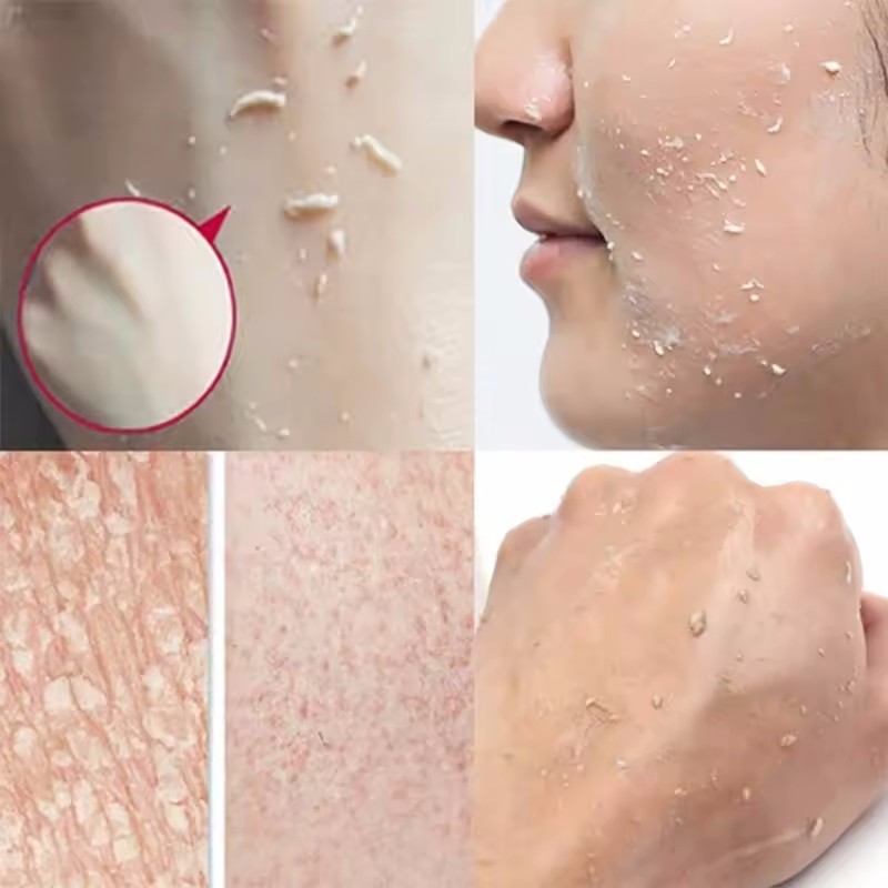 Оранжевый отшелушивающий гель- – обзор и цена Ceramide Moisturizer
