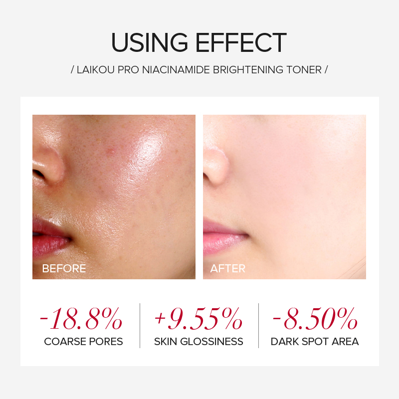 Набор для ухода за кожей LAIKO – обзор и цена Niacinamide Brightening Serum