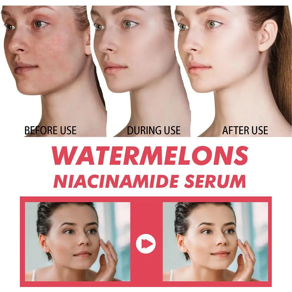 Увлажняющая сыворотка с ниацин – обзор и цена Niacinamide Brightening Serum
